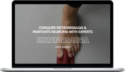 My Foot Function – Metatarsalgia Workshop