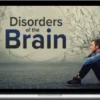 Sandy Neargarder – Understanding Disorders Of The Brain
