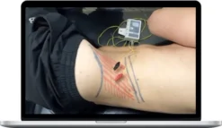 Anthony Lombardi – Chronic Low Back Pain Assessment & Treatment