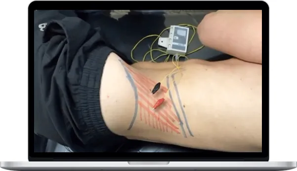 Anthony Lombardi – Chronic Low Back Pain Assessment & Treatment